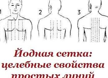 Как делать йодную сетку при кашле ребенку или взрослому?