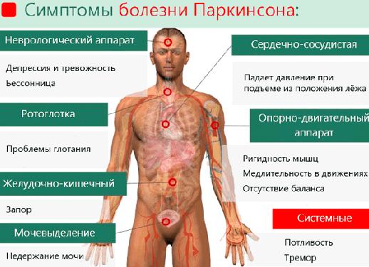 Ригидность мышц, как симптом неврологических заболеваний