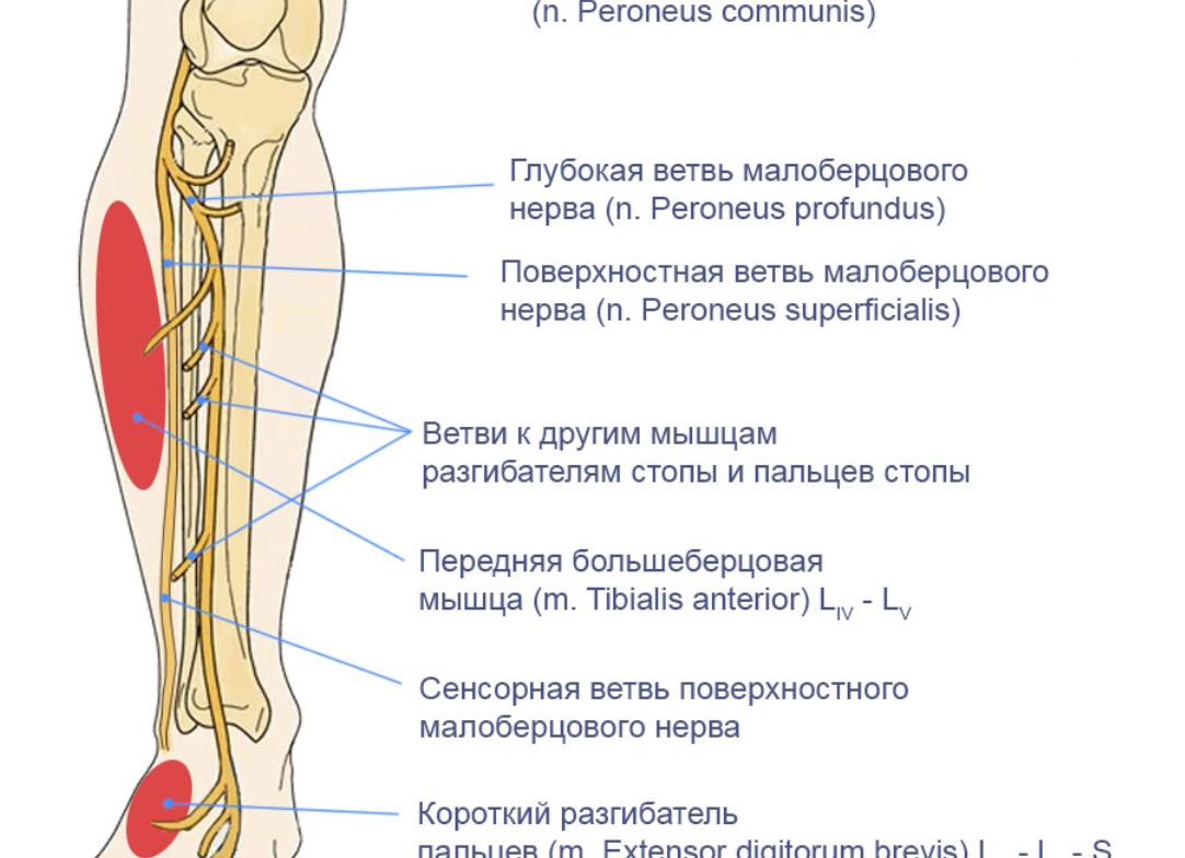 Все про нейропатию малоберцового нерва