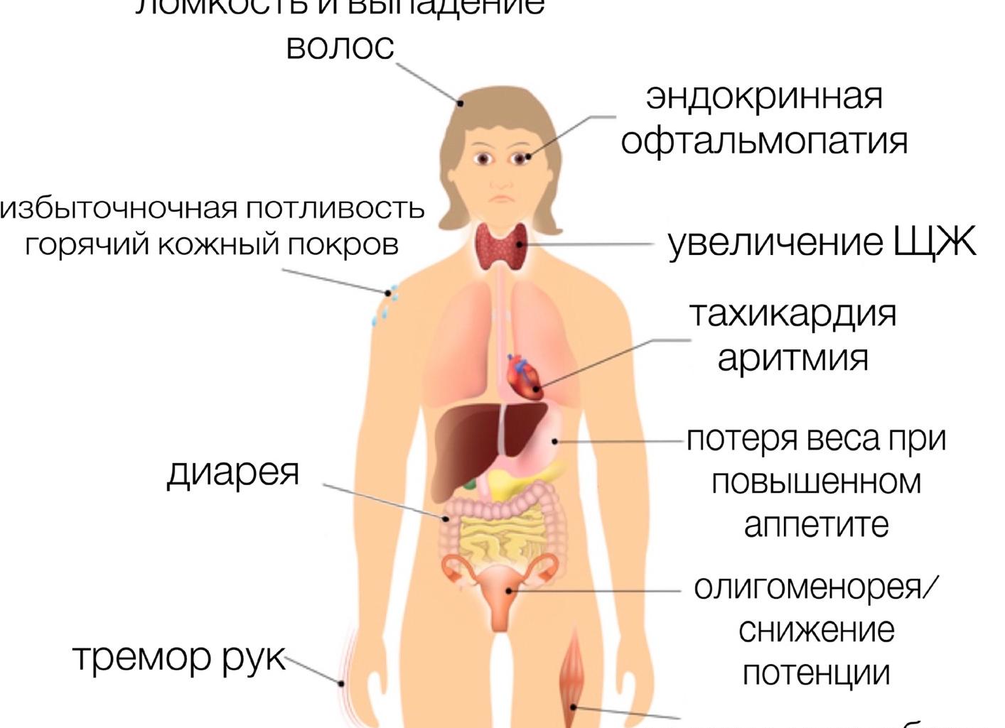 Диффузный зоб: лечение и симптомы