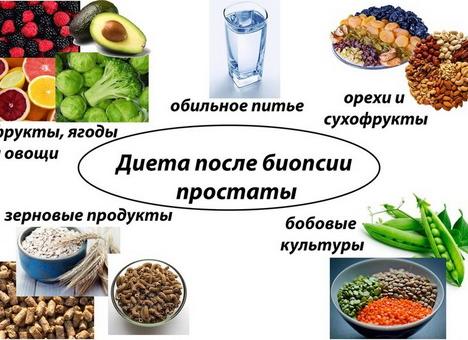 Диета после биопсии простаты — разрешенные продукты и правила питания