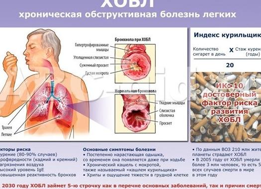 Почему появляется одышка при ходьбе — основные причины