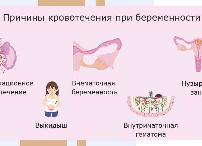 Имплантационное кровотечение — причины возникновения, признаки и отличия от менструации