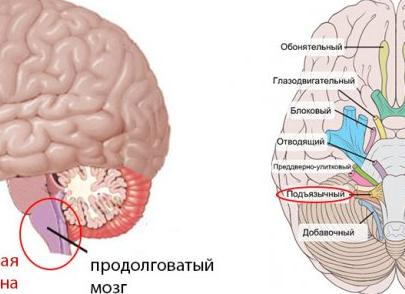 Бульбарный и псевдобульбарный синдромы — схожие симптомы, но разное лечение