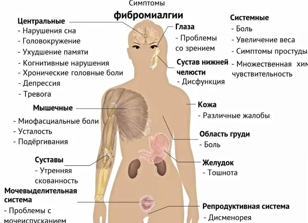Фибромиалгия – лечение у детей и взрослых медикаментами и народными средствами, диета и профилактика