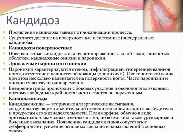 Кандидоз кожи — причины, симптомы и виды заболевания у детей и взрослых