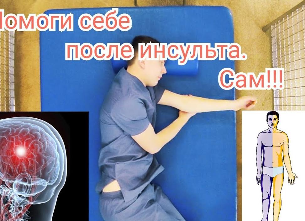 Упражнения после инсульта в домашних условиях для восстановления