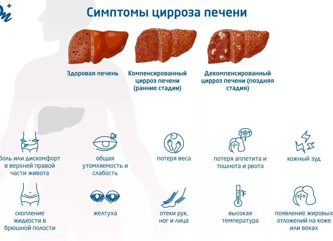 Лечение цирроза печени у мужчин медикаментозными, народными средствами и диетой