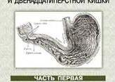 Осложнения язвенной болезни желудка и двенадцатиперстной кишки у больных