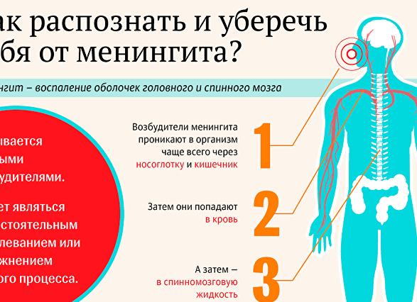 Симптомы менингита у взрослых — первые признаки по типам заболевания