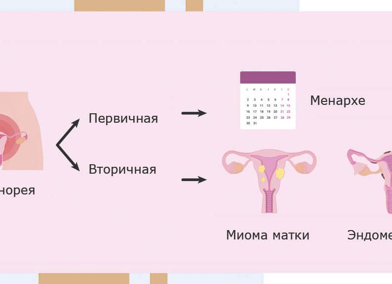 Альгодисменорея – что это такое, причины, симптомы и лечение