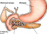Что такое псевдотуморозный панкреатит?