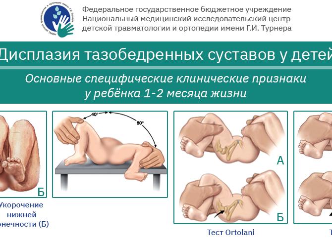 Дисплазия тазобедренных суставов