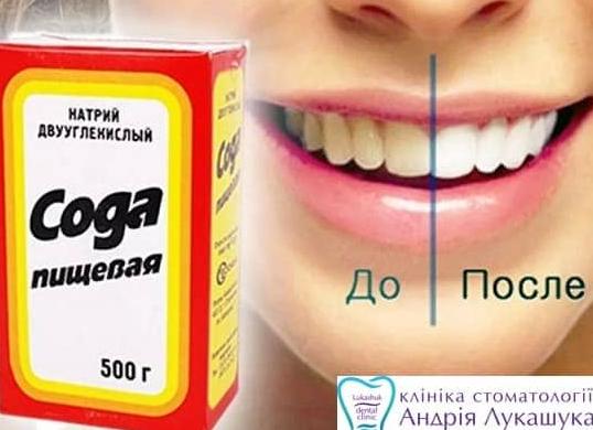 Как и чем можно быстро отбелить зубы в домашних условиях без вреда для эмали?