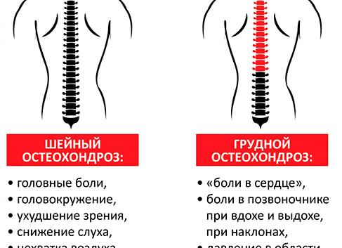 Все про лечение грудного хондроза