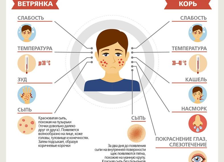 Есть ли кашель при ветрянке и как его лечить у детей и взрослых?