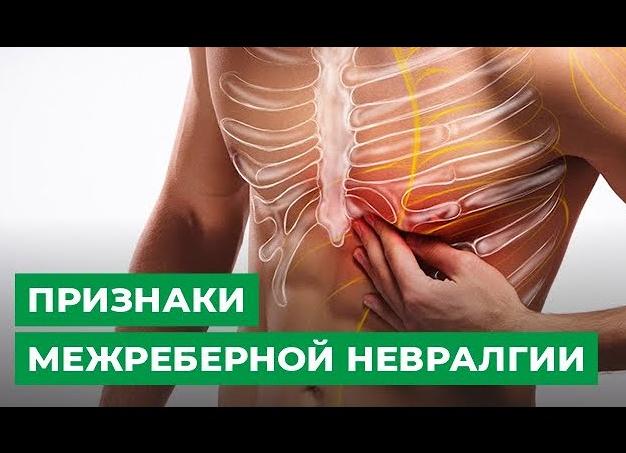 Каковы симптомы межреберной невралгии слева?