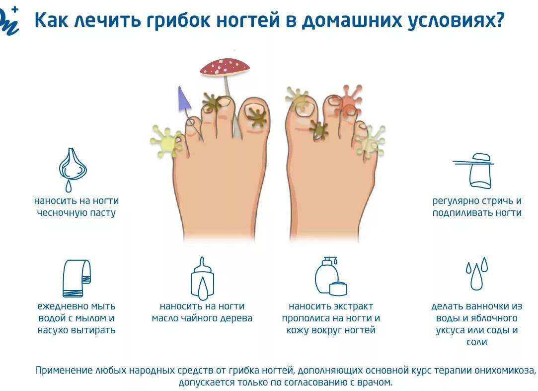Лечение грибка ногтей в домашних условиях эффективными средствами