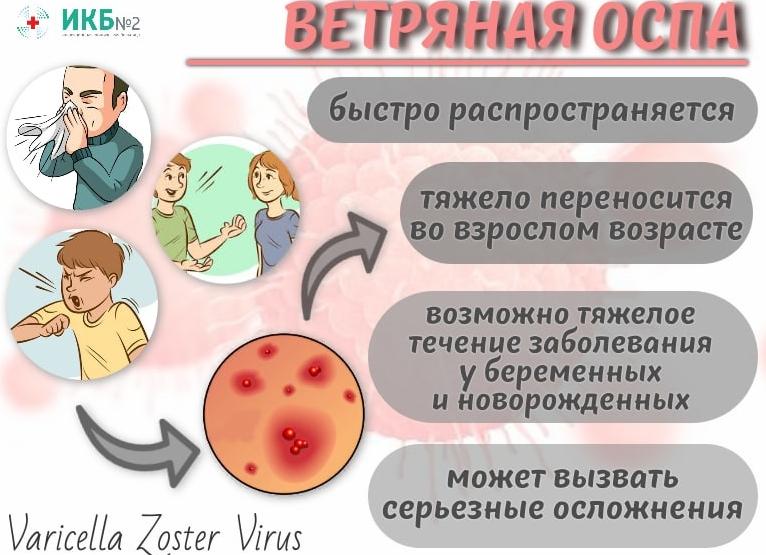 Профилактика ветряной оспы при контакте с больным и плановая вакцинация