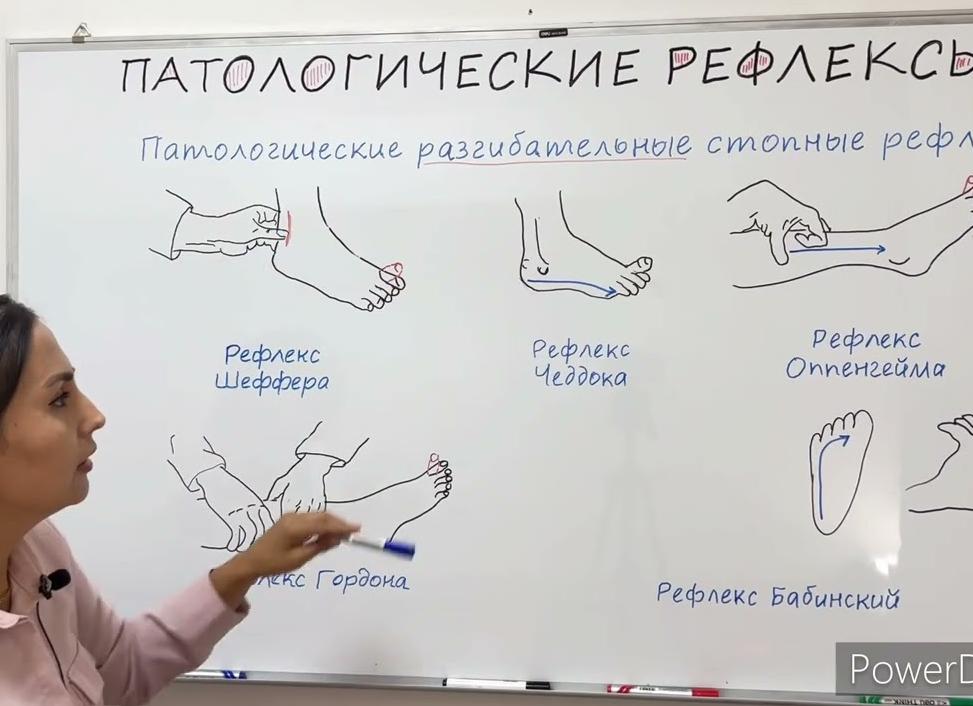 Значение диагностики рефлекса Якобсона-Ласка
