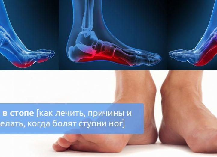 Способы лечения болей в стопах ног