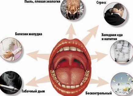 Боль в горле при глотании — причины возникновения и диагностика