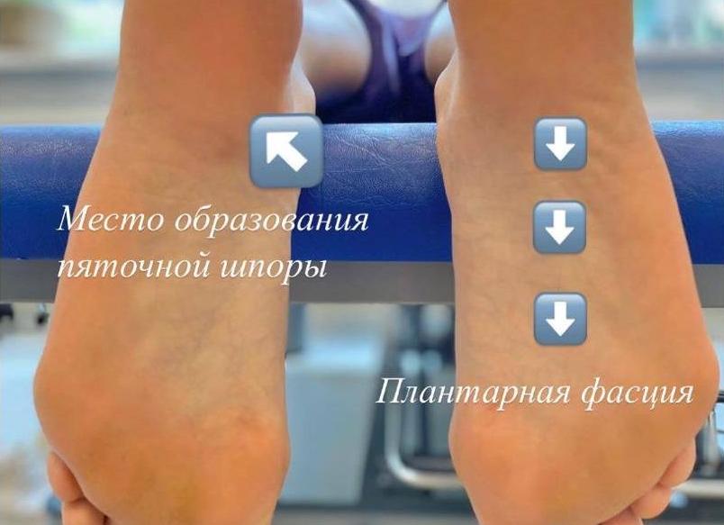 Из за чего может болеть пяточная кость сзади