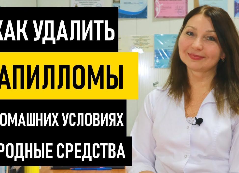 Лечение папиллом народными средствами